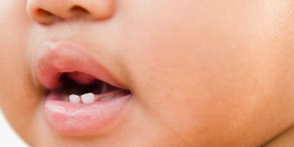 boca de bebé 2 dientes