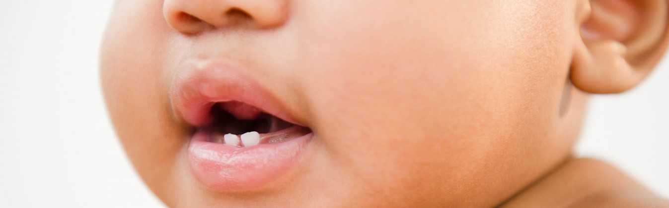 boca de bebé 2 dientes