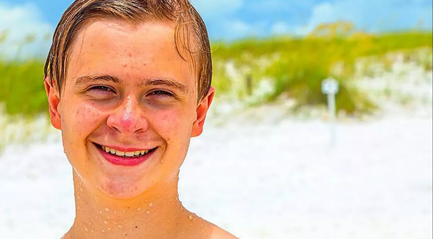 adolescente con acné